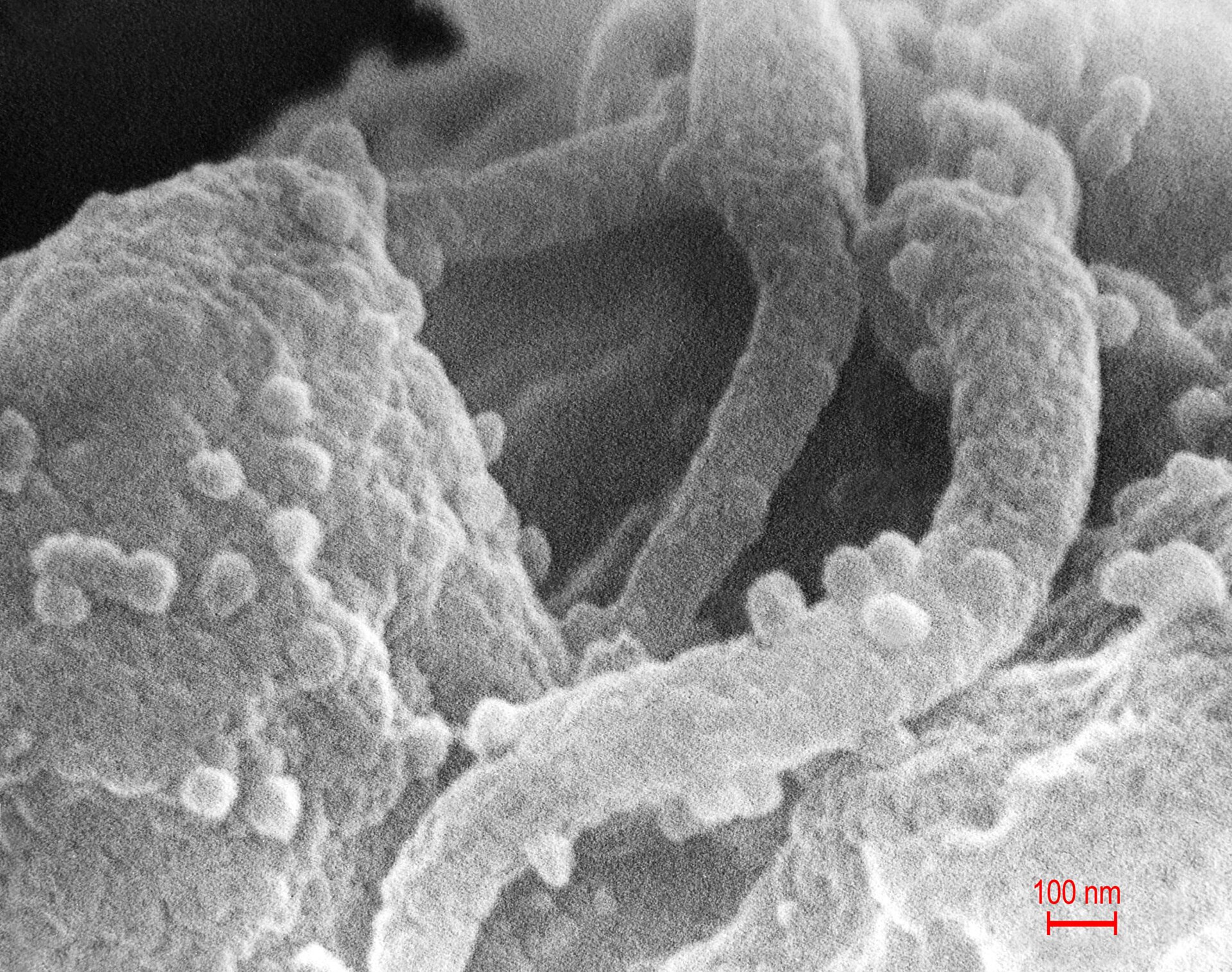 培養したリンパ球の表面から出芽するHIVの粒子を写した走査電子顕微鏡写真