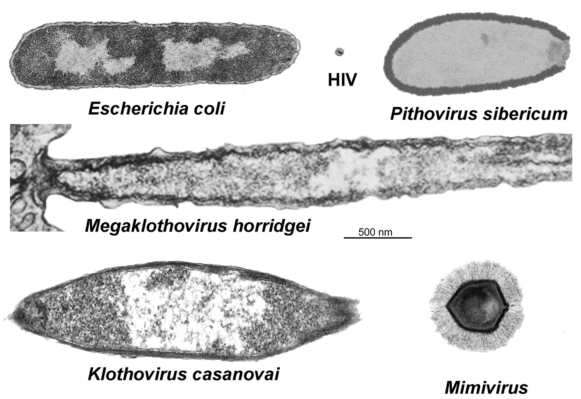 大腸菌、HIV、ピトウイルスなどの巨大ウイルスを同じ縮尺で並べた比較図