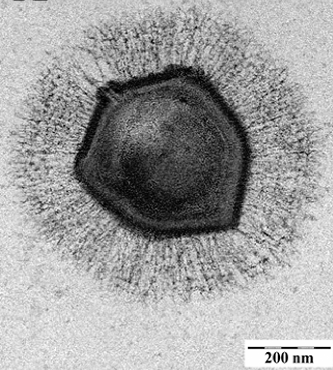 繊維に囲まれた六角形のミミウイルスの粒子の電子顕微鏡写真